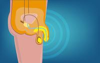 Can a man produce sperm and get a woman pregnant after prostate surgery?
